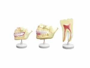 ZM1048 deciduous tooth permanent tooth dentition model